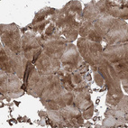 Immunohistochemical staining of human skeletal muscle shows strong cytoplasmic positivity in myocytes.