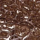 Immunohistochemical staining of human kidney shows strong cytoplasmic-membranous positivity in cells in tubules.