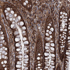 Immunohistochemical staining of human rectum shows strong cytoplasmic-membranous positivity in glandular cells and lymphoid cells.