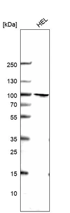 Western blot analysis in human cell line HEL.