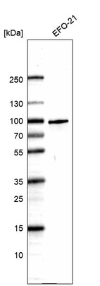 Western blot analysis in human cell line EFO-21.