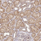 Immunohistochemical staining of human kidney shows strong cytoplasmic positivity in cells in tubules.