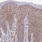 Immunohistochemical staining of human skin shows strong cytoplasmic positivity in squamous epithelial cells.