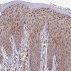 Immunohistochemical staining of human skin shows strong cytoplasmic positivity in squamous epithelial cells.