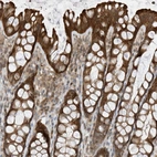 Immunohistochemical staining of human rectum shows strong cytoplasmic positivity in glandular cells.