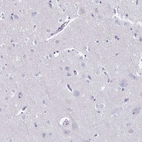 Immunohistochemical staining of human cerebral cortex shows no positivity in neurons as expected.