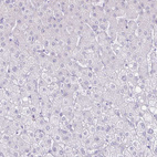 Immunohistochemical staining of human liver shows no positivity in hepatocytes as expected.
