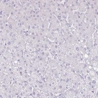 Immunohistochemical staining of human liver shows no positivity in hepatocytes as expected.
