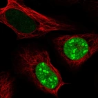 Immunofluorescent staining of human cell line U-2 OS shows localization to nucleus & nucleoli.
