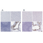 Immunohistochemical staining of human cerebral cortex, liver, lymphoid tissues and testis using Anti-CT45A1 antibody HPA046872 (A) shows similar protein distribution across tissues to independent antibody HPA044735 (B).