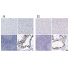 Immunohistochemical staining of human cerebral cortex, liver, lymphoid tissues and testis using Anti-CT45A1 antibody HPA046872 (A) shows similar protein distribution across tissues to independent antibody HPA044735 (B).