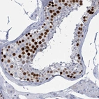 Immunohistochemical staining of human testis shows strong nuclear positivity in cells in seminiferous ducts.