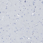 Immunohistochemical staining of human cerebral cortex shows no positivity in neurons as expected.