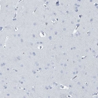Immunohistochemical staining of human cerebral cortex shows no positivity in neurons as expected.