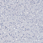 Anti-CT45A1 Antibody
