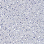 Immunohistochemical staining of human liver shows no positivity in hepatocytes as expected.
