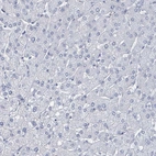 Immunohistochemical staining of human liver shows no positivity in hepatocytes as expected.