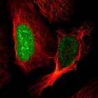 Immunofluorescent staining of human cell line U-2 OS shows localization to nucleus & nucleoli.