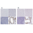Immunohistochemical staining of human cerebral cortex, liver, lymphoid tissues and testis using Anti-CT45A1 antibody HPA046987 (A) shows similar protein distribution across tissues to independent antibody HPA044735 (B).