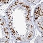 Immunohistochemical staining of human testis shows strong nuclear positivity in cells in seminiferous ducts.