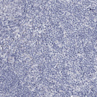 Anti-CT45A1 Antibody