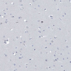 Anti-CT45A1 Antibody