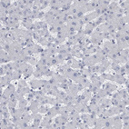 Immunohistochemical staining of human liver shows no positivity in hepatocytes as expected.