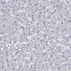Immunohistochemical staining of human liver shows no positivity in hepatocytes as expected.