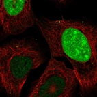 Immunofluorescent staining of human cell line U-2 OS shows localization to nucleus & nucleoli.