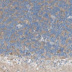 Immunohistochemical staining of human cerebellum shows strong membranous/ cytoplasmic positivity in cells in granular layer.