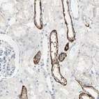 Immunohistochemical staining of human kidney shows strong membranous positivity in cells in distal tubules.