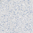 Anti-TMIGD2 Antibody