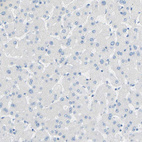Immunohistochemical staining of human liver shows no positivity in hepatocytes as expected.