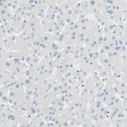 Immunohistochemical staining of human liver shows no positivity in hepatocytes as expected.