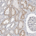 Immunohistochemical staining of human kidney shows moderate cytoplasmic positivity in cells in tubules.