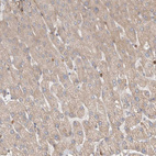 Immunohistochemical staining of human liver shows moderate cytoplasmic positivity in hepatocytes.