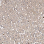 Immunohistochemical staining of human liver shows moderate cytoplasmic positivity in hepatocytes.