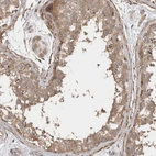 Immunohistochemical staining of human testis shows moderate cytoplasmic positivity in cells in seminiferous ducts.