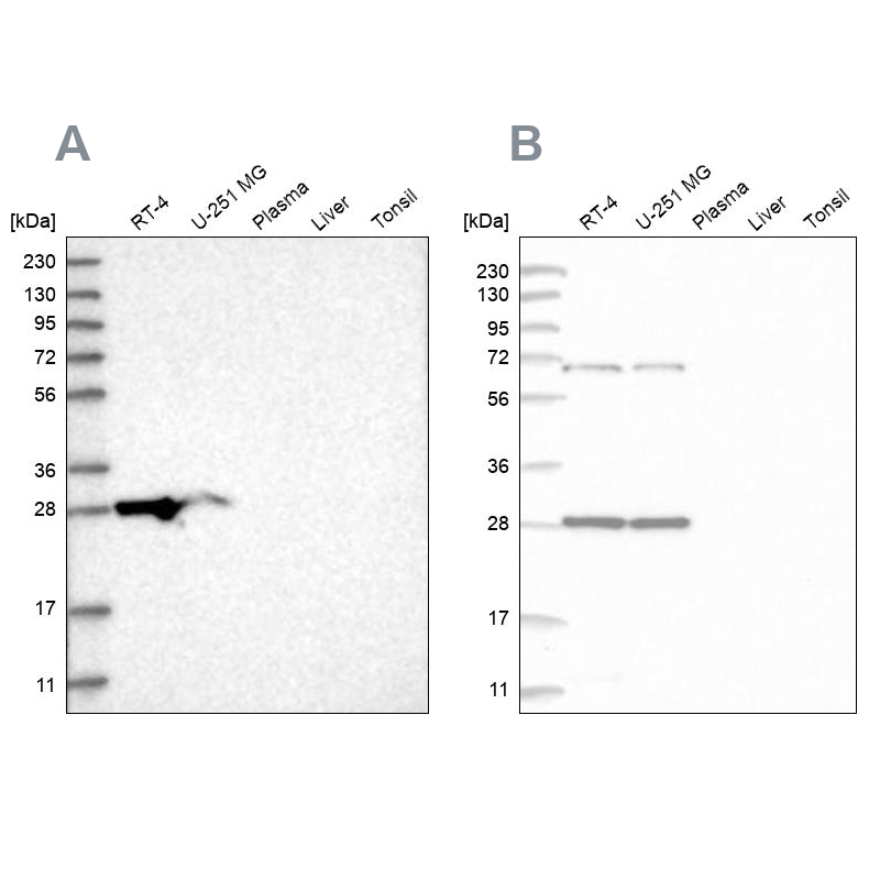 Anti-MRPL10 Antibody