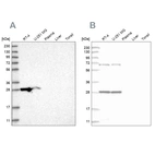 Anti-MRPL10 Antibody