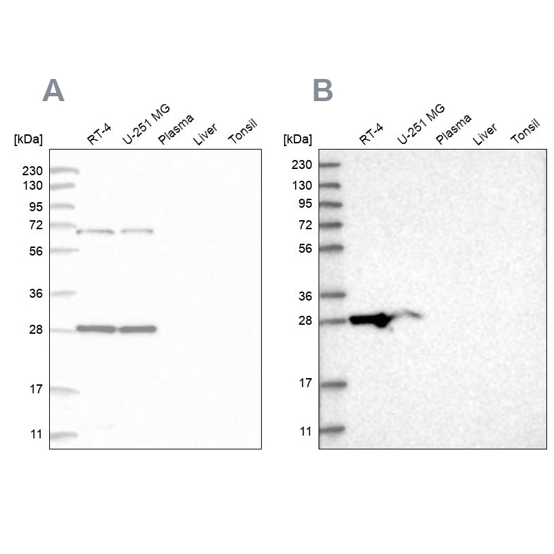 Anti-MRPL10 Antibody
