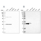 Anti-MRPL10 Antibody