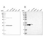 Anti-MRPL10 Antibody