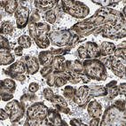 Immunohistochemical staining of human placenta shows moderate cytoplasmic membranous positivity in trophoblastic cells.