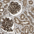 Immunohistochemical staining of human kidney shows strong cytoplasmic membranous positivity in cells in glomeruli and cells in tubules.