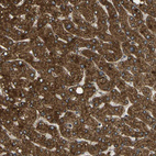 Immunohistochemical staining of human liver shows strong cytoplasmic positivity in hepatocytes.