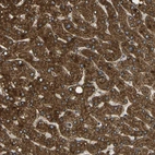 Immunohistochemical staining of human liver shows strong cytoplasmic positivity in hepatocytes.