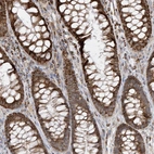 Immunohistochemical staining of human rectum shows strong cytoplasmic-granular positivity in glandular cells.
