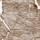 Immunohistochemical staining of human skeletal muscle shows moderate cytoplasmic-granular positivity in myocytes.