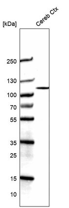 Western blot analysis in human cerebral cortex tissue.